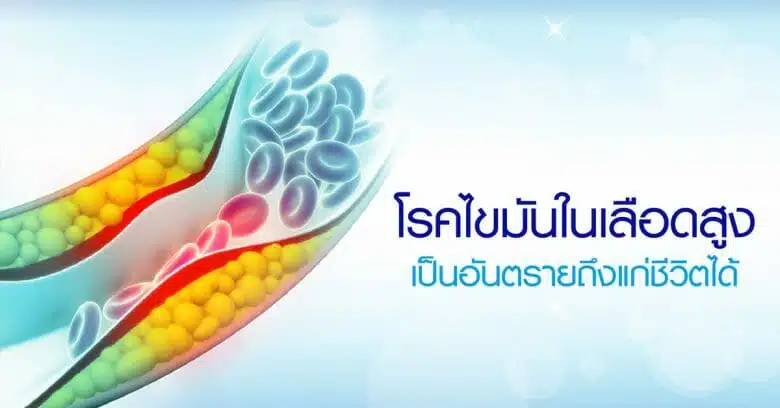 โรคไขมันในเลือดสูง